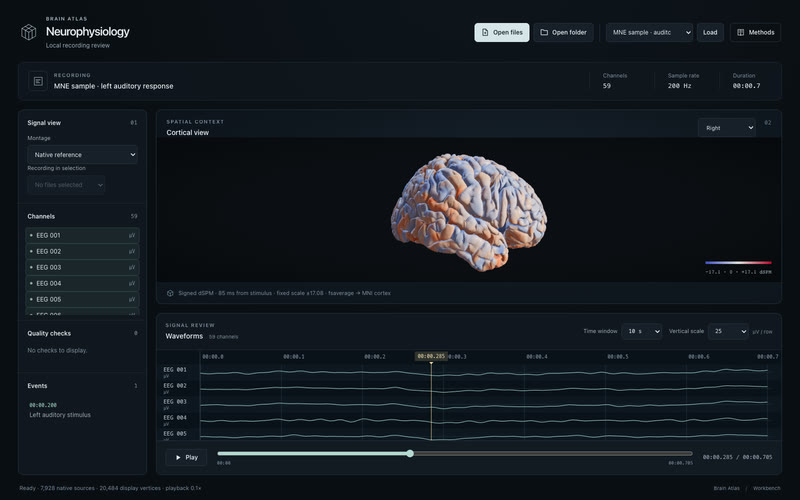 Local EEG, linked cortical sources.