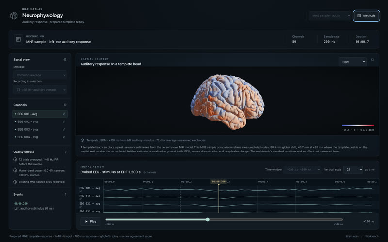 An auditory response on a template head.