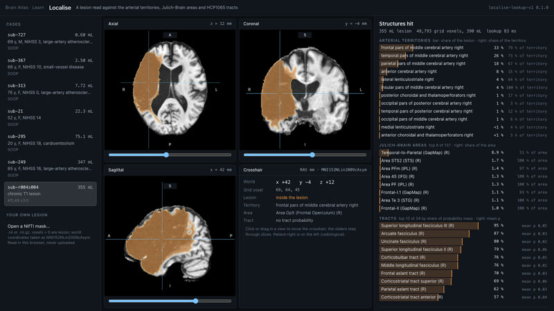 Localise, day 2: the dev page reads a real lesion live.