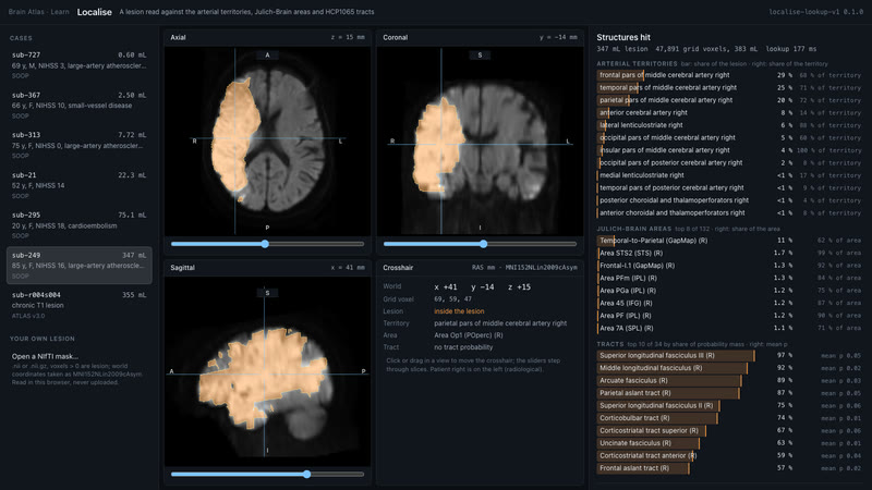Localise, day 2: the dev page reads a real lesion live., view 2