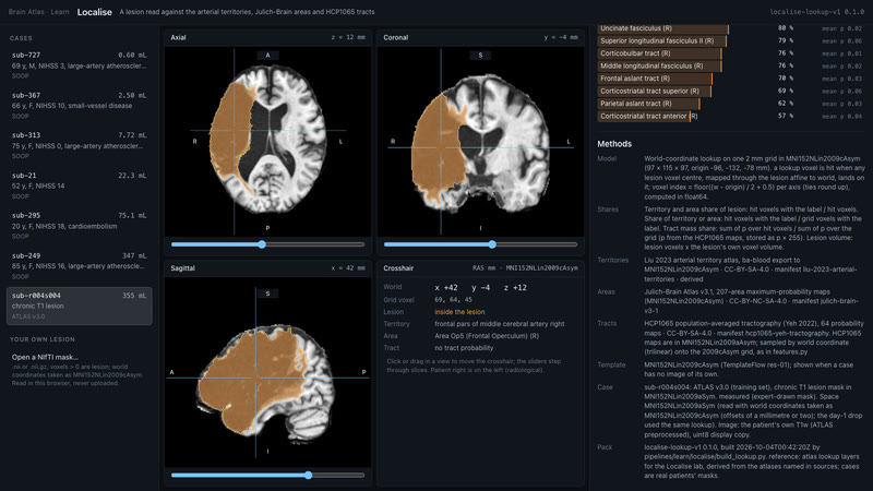 Localise, day 2: the dev page reads a real lesion live., view 3