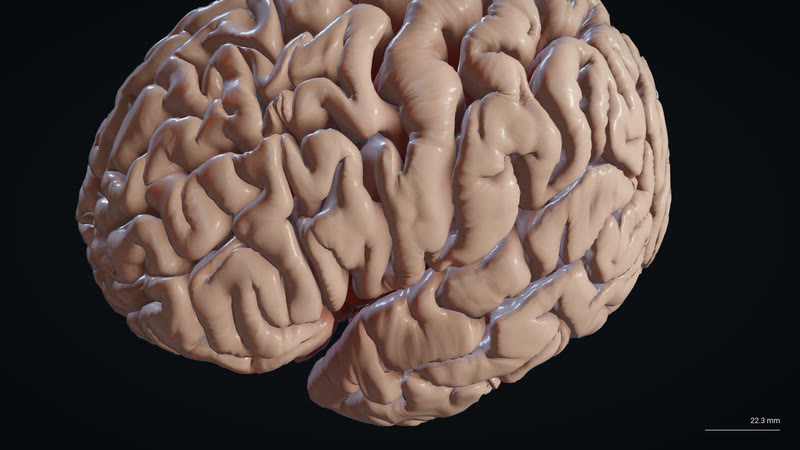 The whole brain.