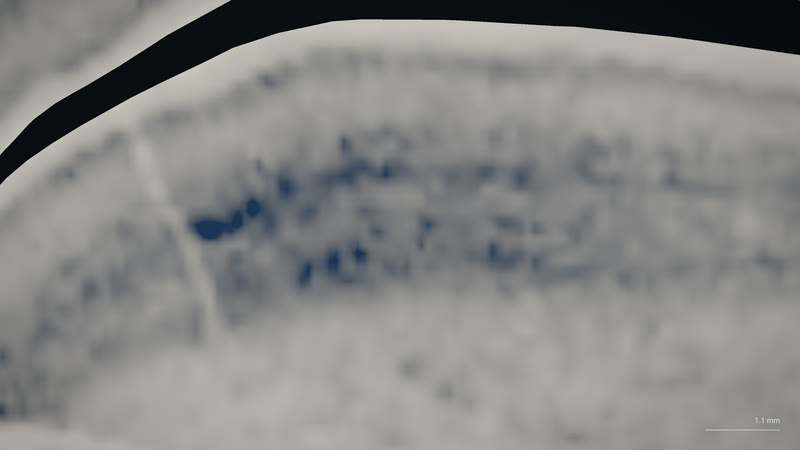 Histology at 100 µm.