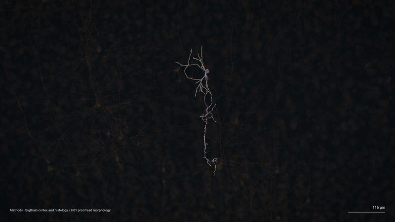 One neuron.