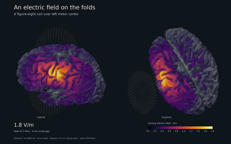 An electric field on the folds.