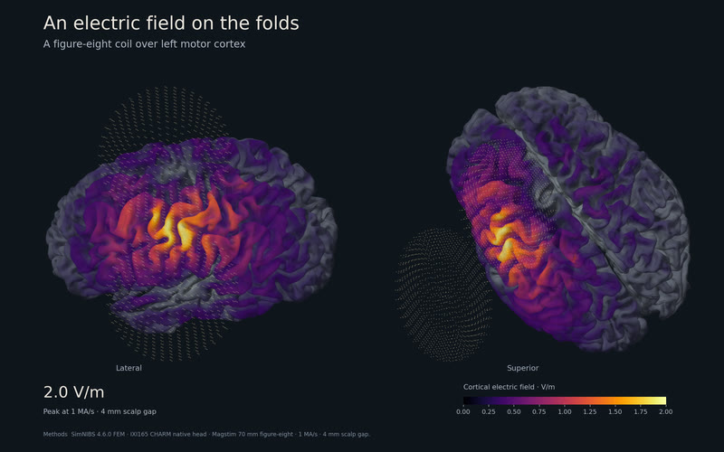 TMS on the IXI165 cortex.