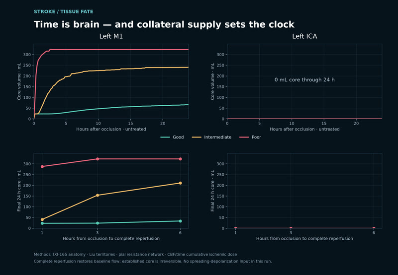 Time is brain, in millilitres.