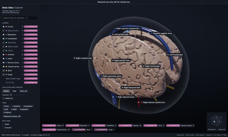 The same brain in Chrome.