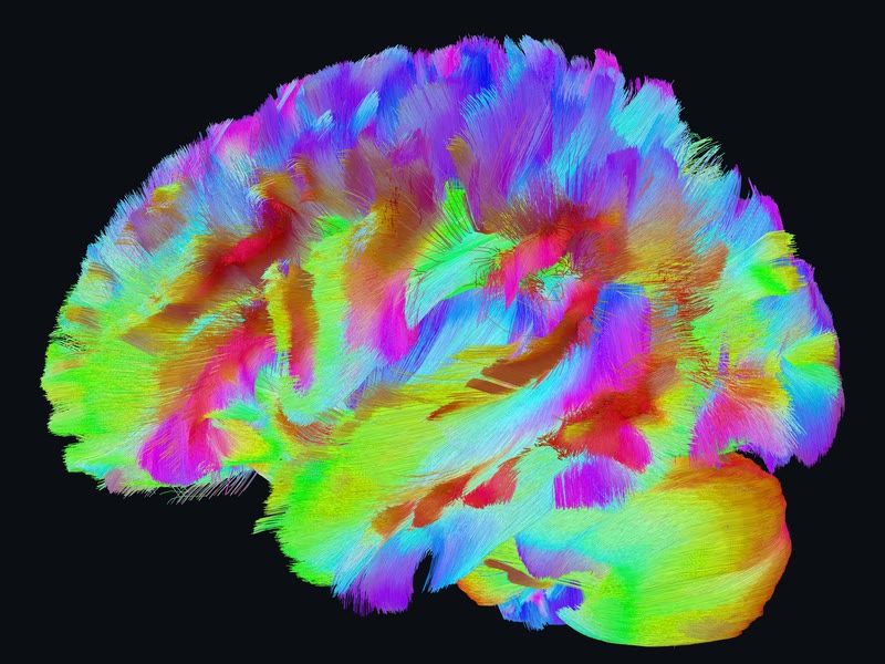 The dense tract pack, lateral view.