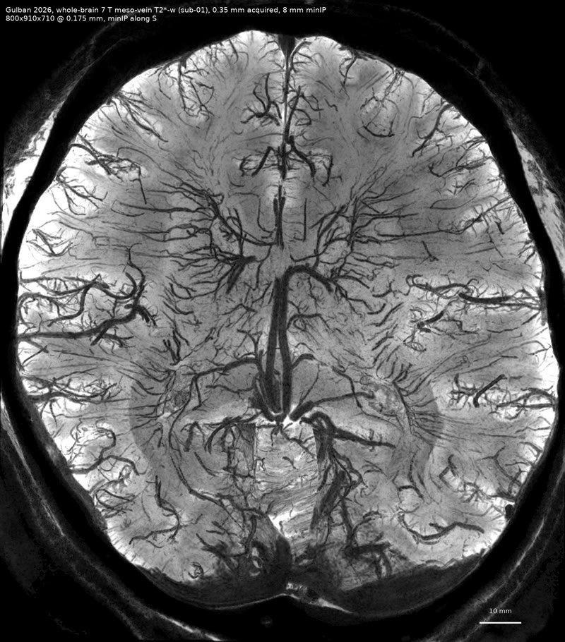 Whole-brain veins at 7 T.