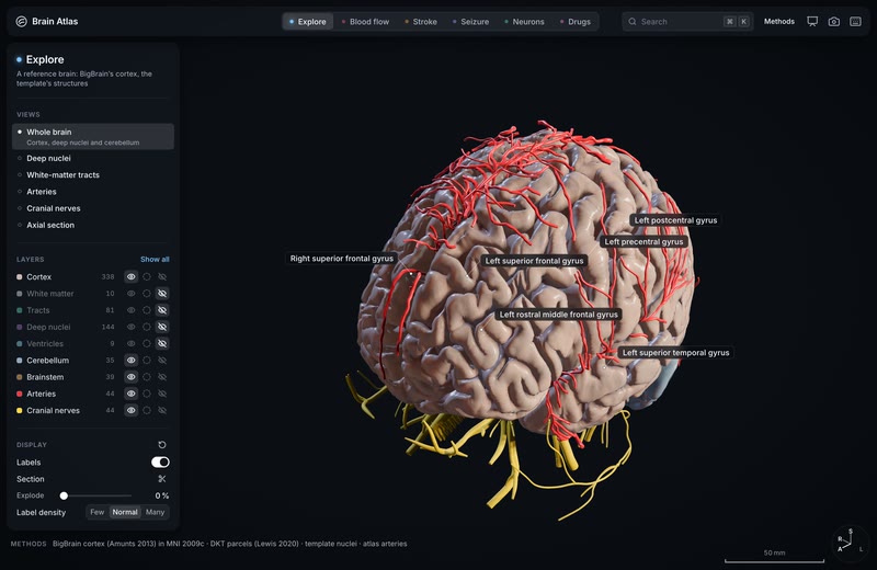 Explore opens on BigBrain's cortex.