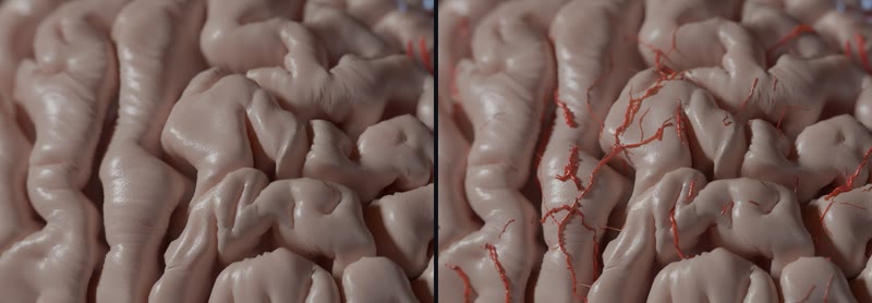 Real pial arteries on BigBrain's cortex.