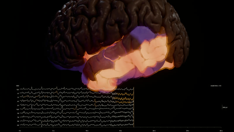 Recruitment: the temporal lobe lit at 17 s.