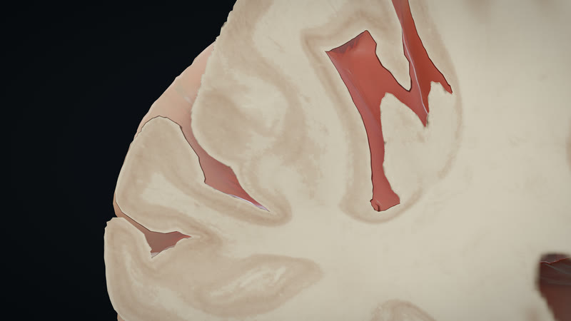 The stain, up close.