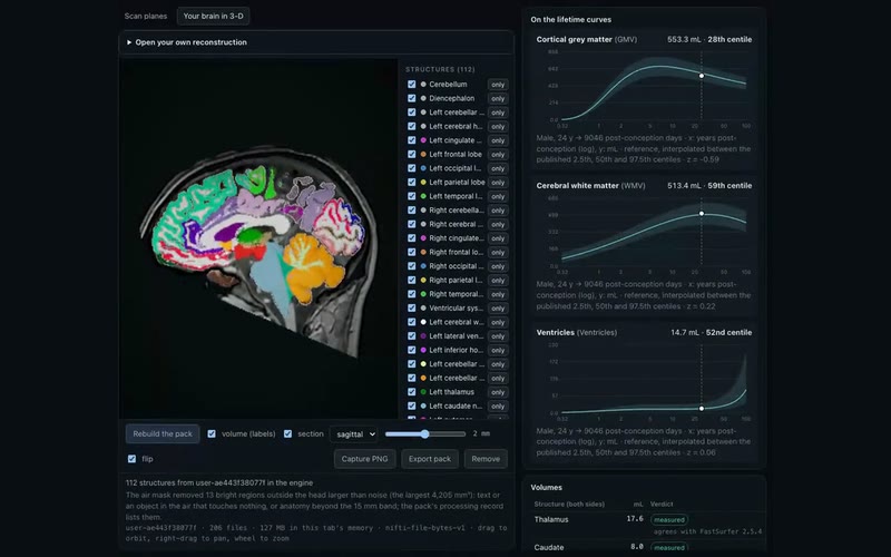 The Scan Lab in a browser: a sagittal slice of a brain coloured by its segmented structures, a list of 112 structures, and three lifetime curves for grey matter, white matter and ventricles with the scan's point on each.